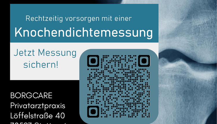 Knochendichtemessung in Stuttgart: Termine im Juli sichern